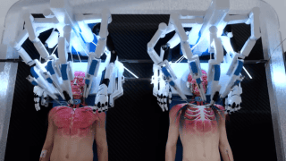 W sieci krąży filmik przedstawiający wizualizację przeszczepu głowy, realizowaną przez robotyczne ramiona. Jednak to tylko koncepcja, a nie badania naukowe.