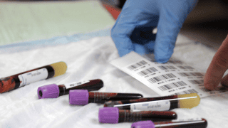 Ubiegłoroczny cyberatak, który spowodował poważne opóźnienia w wykonywaniu badań krwi, przyczynił się do śmierci pacjenta